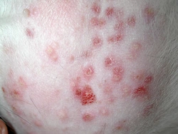 Vlooienallergie dermatitis